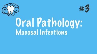 Oral Pathology  Mucosal Infections  INBDE ADAT [upl. by Sibella604]