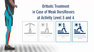 FIOR amp GENTZ  The Right Orthosis in Case of Paralysed Dorsiflexors  Activity Level 3 and 4 [upl. by Sosanna]