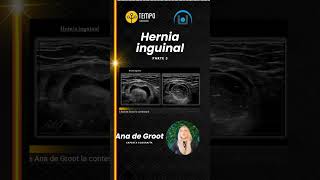 Hernia inguinal y ecografía parte 3 con Ana de Groot [upl. by Catt]