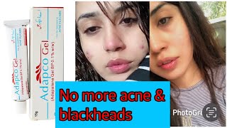 How to use Tretinoin  Skincare products Layer step by step skincare tretinoin [upl. by Ancell736]