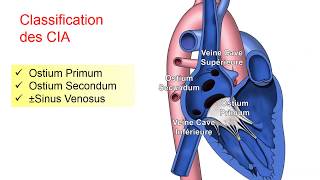 FMPM MOOCs  Les cardiopathies congénitales de lenfant  Pr N El Idrissi Slitine [upl. by Roxane398]