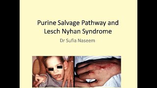 Purine salvage pathway and Lesch Nyhan Syndrome [upl. by Nonnad]