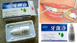 Yabanjing Teeth Whitening Review [upl. by Gio]