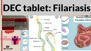 Drug For Filariasis DEC  Diethylcarbamazine and Antihistamine CPM [upl. by Armond]