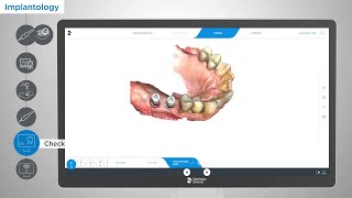 Streamlining Excellence Implantology Workflow with Primescan [upl. by Ainej]