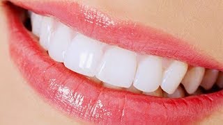 As Próteses Dentárias de Silicone Removíveis com Dentes de Acrílico ou Porcelana Existe [upl. by Arodnahs]