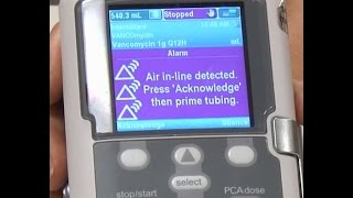 Air In line Alarms  CADD® Solis Ambulatory Infusion Pump [upl. by Weisburgh]