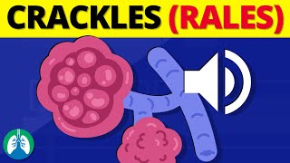 Crackles Rales  Medical Definition and Explanation [upl. by Bethena]