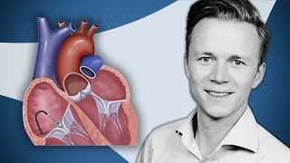 Hemodynamic implications of TTVI on right heart function  Tricuspid Focus Group [upl. by Peppi]