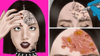 ASMR Animation Remove Tattoo amp Forehead wound Treatment for girls  WOW Brain Removal [upl. by Carlie]