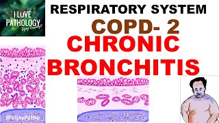 Chronic Obstructive Pulmonary Disease Part 2 Chronic Bronchitis  Pathology [upl. by Anaert]