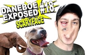 Daneboe Exposed 18 SCARYFACE [upl. by Deeraf]