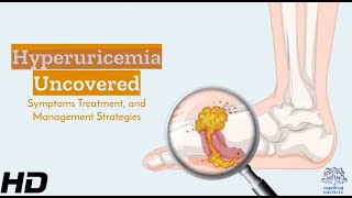 Hyperuricemia Understanding Its Signs Effects amp Management Essentials [upl. by Acirne375]