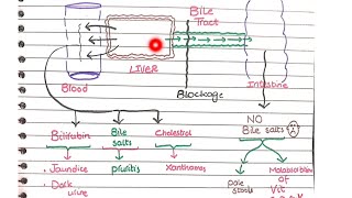 Cholestasis  Pathology [upl. by Idnyl965]