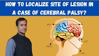 Cerebral palsy in Paediatrics localization of lesion site in different types of cerebral palsy [upl. by Aihsemek]