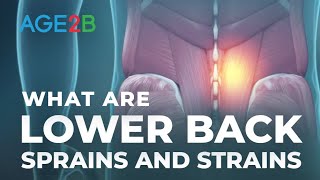 What Are Lower Back Sprains and Ligament Strains  Lower Back Pain Relief [upl. by Palmira659]