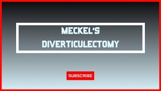 ETC 004 Laparoscopic Meckels Diverticulectomy [upl. by Gussie461]