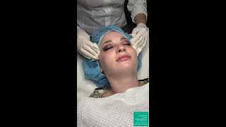 San Diego Medical Aesthetician Demonstrates The Dermaplaning Skin Rejuvenation Procedure [upl. by Enimajneb]