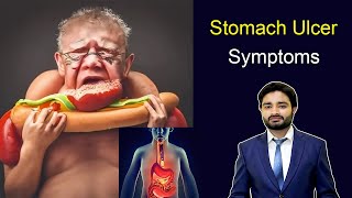 Stomach Ulcer Symptoms  peptic ulcer  Duodenum ulcer  Ulcer symptoms  medical videos  Doctor [upl. by Remot]