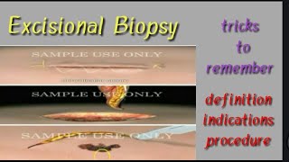 Types of biopsyExcisional biopsypart 3 [upl. by Maharva416]