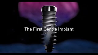 NEVO  The First Gentle Implant [upl. by Mouldon]