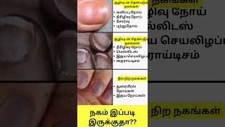 நகம் இப்படி இருக்குதா Nail Disorders in Tamil Shorts intamizh [upl. by Pascal]