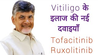 Vitiligo के इलाज की नई दवाइयाँ  Tofacitinib Ruxolitinib सफ़ेद दाग़ का इलाज leucoderma vitiligo [upl. by Dawes]