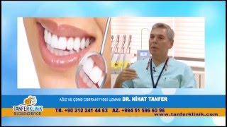 Tanfer Klinikasi  Gözəl təbəssüm [upl. by Tierza]