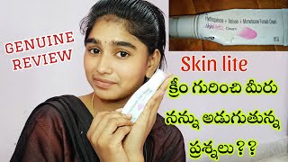 skin light క్రీం వాడి ఆపిన తర్వాత ఇంకా నల్లగా అయ్యారా Skin lite genuine review side effectstips [upl. by Audrie]