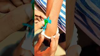 Jelco procedure IV Cannula seting and saline given hospital medical technology short viral [upl. by Inej]