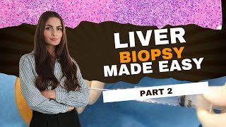 Liver Biopsies Diagnosis made easy  Case Discussion  Part 2 [upl. by Alfy383]