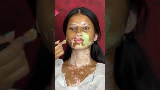 Vitiligo skin makeup trending makeuptutorial yshorts viralvideos makeupartist vitiligomodel [upl. by Solracnauj985]