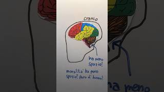 Le ASSURDE TEORIE di CESARE LOMBROSO 🧠 lombroso criminale teoria frenologia imparaconyoutube [upl. by Eneri]