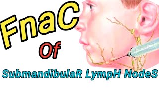 Fineneedle Aspiration cytology of Submandibular Lymph Nodes।। [upl. by Adnawuj]