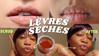 Comment Avoir Les Lèvres Roses En 5 Minutes  Exfoliant Rapide [upl. by Reace]