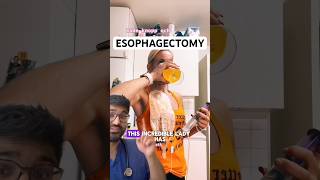 DOCTOR REACTS to ESOPHAGECTOMY and ESOPHAGOSTOMY [upl. by Neillij616]