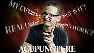 Does Acupuncture REALLY WORK My Personal Experience [upl. by Tarton]