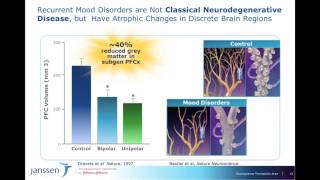 Bipolar Disorder Harnessing Brain Plasticity for Improved Overall Outcomes [upl. by Sall]