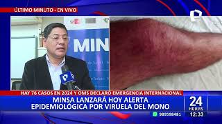 Minsa emitirá alerta epidemiológica por nueva variante de viruela del mono en África [upl. by Michelsen]