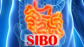 Small Intestinal Bacterial Overgrowth SIBO [upl. by Zipah]