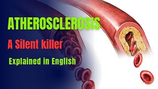 Atherosclerosis explained in English [upl. by Lleznol24]