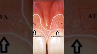 Important topicjunctional epitheliumwatch full video on our channel [upl. by Thedric]