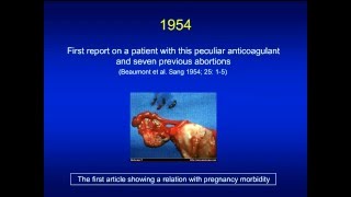 Antiphospholipid syndrome [upl. by Nnaeirelav]