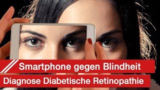 Das Smartphone und die Diabetische Retinopathie Der Kampf gegen die Blindheit in Indien [upl. by Notsag]