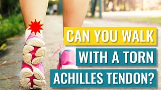 Can You Walk on a Torn Achilles Tendon Partial  Full Ruptures [upl. by Niran920]