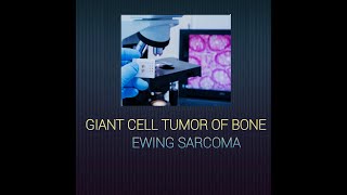 Giant cell tumor of bone amp Ewing sarcoma giantcelltumor ewingsarcoma systemicpathology [upl. by Hadden]