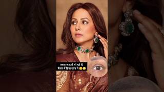 Hina Khan Ke Eyelashes Bhi Chale Gaye Cancer Me😔 hinakhan [upl. by Oicnevuj527]