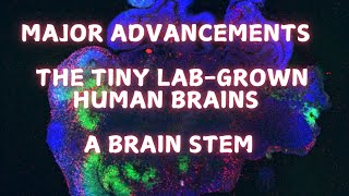 Giving the labgrown brains a brainstem [upl. by Guillema]