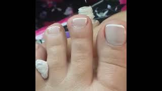 French Pedicure Makeover [upl. by Clements]