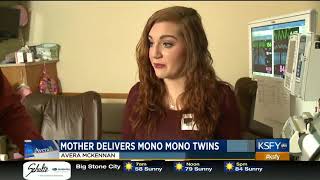 Mothers pregnancy journey with Mono Mono twins  Medical Minute [upl. by Htyderem370]